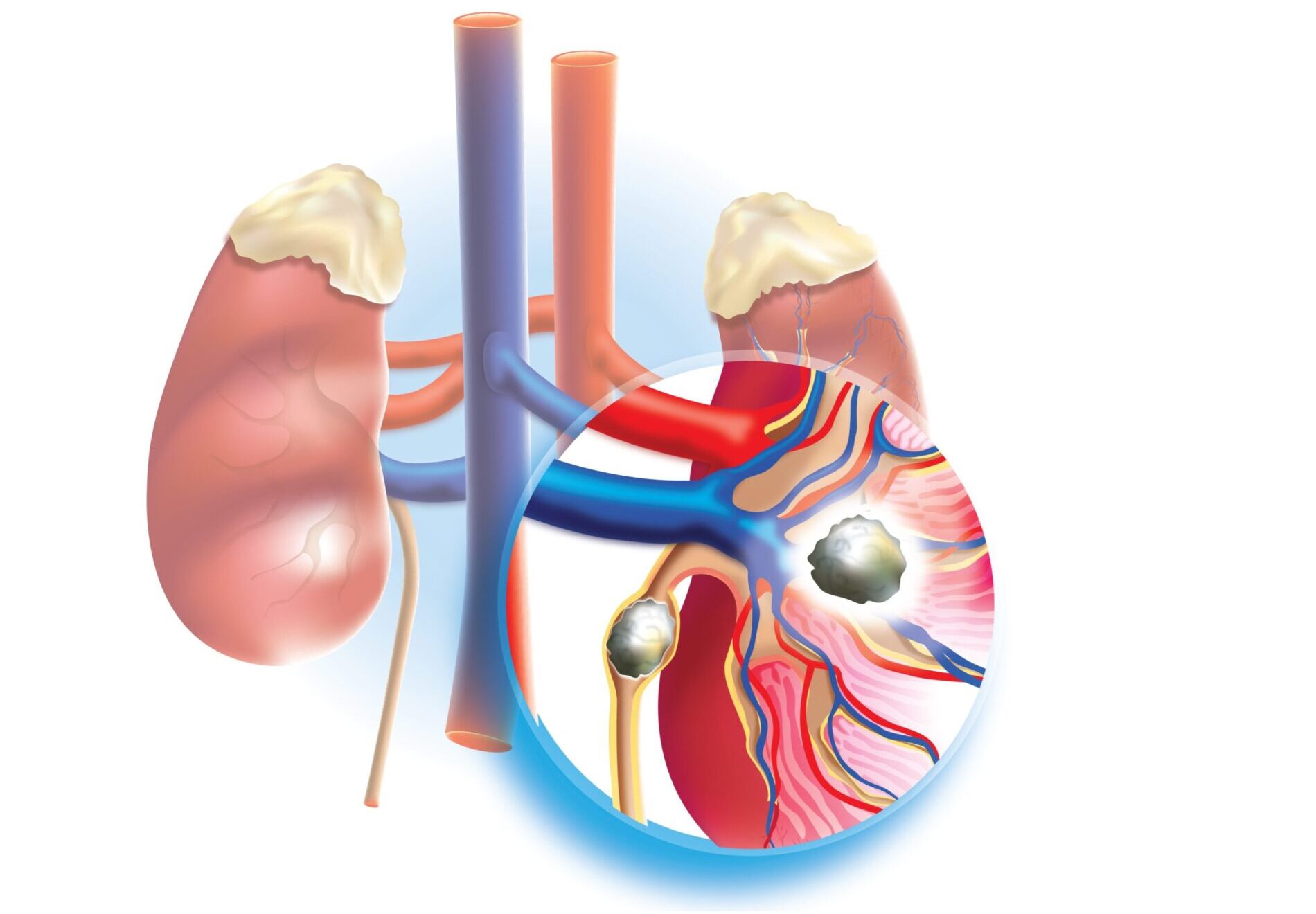 Haben Sie Blasen, Nieren, Prostata-Beschwerden? UROHEALTH / Urologie Frauenfeld, Dr. med. Anja Sauck, Telefon 052 721 39 46