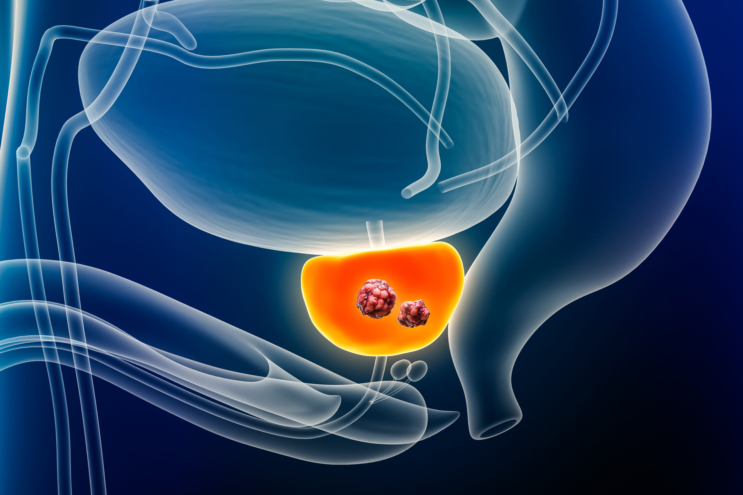 Haben Sie Blasen, Nieren, Prostata-Beschwerden? UROHEALTH / Urologie Frauenfeld, Dr. med. Anja Sauck, Telefon 052 721 39 46
