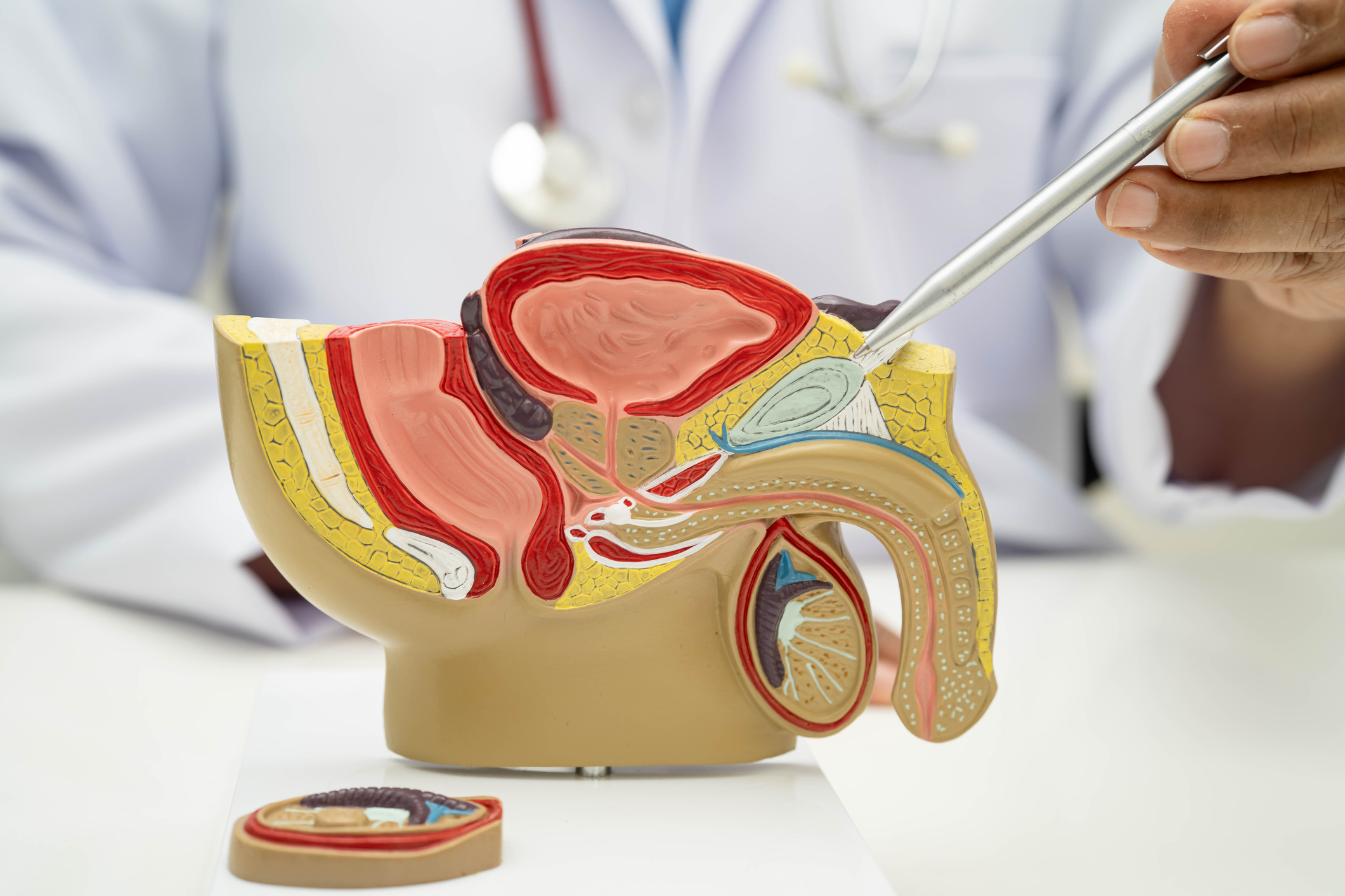Haben Sie Blasen, Nieren, Prostata-Beschwerden? UROHEALTH / Urologie Frauenfeld, Dr. med. Anja Sauck, Telefon 052 721 39 46