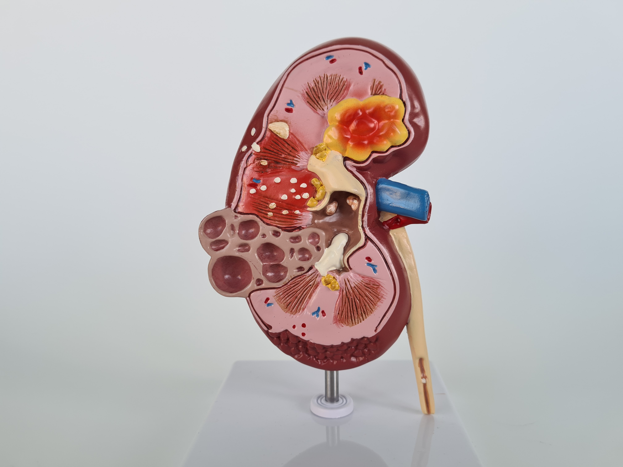 Haben Sie urologische Beschwerden und benötigen Sie einen Termin bei einem Urologen, einer Urologin: Dr. med. Anja Sauck, Telefon 052 721 39 46