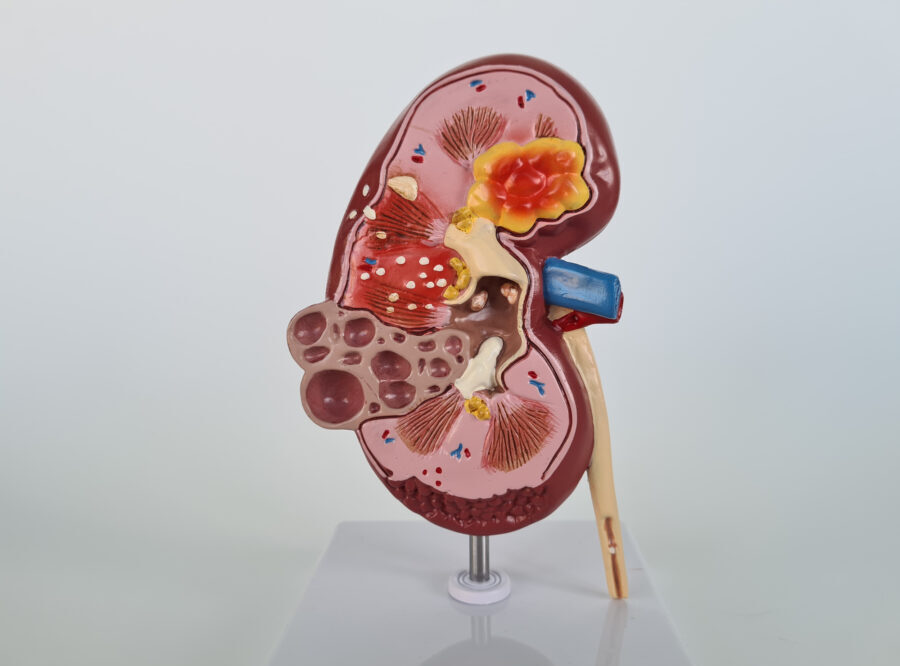 Haben Sie urologische Beschwerden und benötigen Sie einen Termin bei einem Urologen, einer Urologin: Dr. med. Anja Sauck, Telefon 052 721 39 46